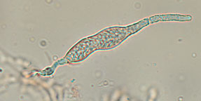 Gloeocystidiellum porosum